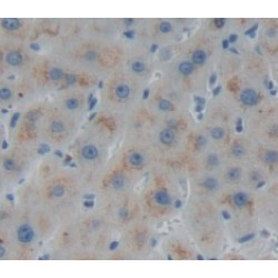 NADH Ubiquinone Oxidoreductase Core Subunit S1 (NDUFS1) Antibody
