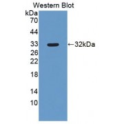 Western blot analysis of recombinant Human OASL Protein.