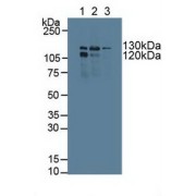 Western blot analysis of (1) Human K562 Cells, (2) Human Jurkat Cells and (3) Human A549 Cells.