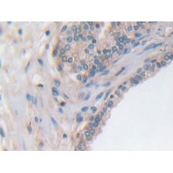 Utrophin (UTRN) Antibody