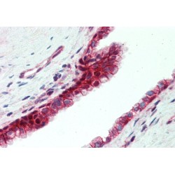 Utrophin (UTRN) Antibody