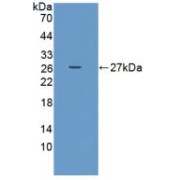 Western blot analysis of recombinant Human ADAMTS9.