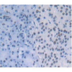 Cleavage And Polyadenylation Specific Factor 1 (CPSF1) Antibody