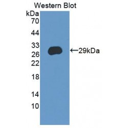 Cysteine Rich Secretory Protein 3 (CRISP3) Antibody