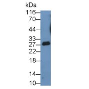 Western blot analysis of Cow milk, using Casein Kappa (CSN3) Antibody (1 µg/ml) and HRP-conjugated Goat Anti-Rabbit antibody (<a href="https://www.abbexa.com/index.php?route=product/search&amp;search=abx400043" target="_blank">abx400043</a>, 0.2 µg/ml).
