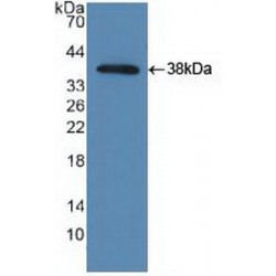 TANK Binding Kinase 1 (TBK1) Antibody