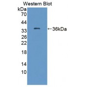 Western blot analysis of recombinant Human TKT protein.