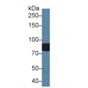 Western blot analysis of Human Serum, using Human TAT1 Antibody (2 µg/ml) and HRP-conjugated Goat Anti-Rabbit antibody (<a href="https://www.abbexa.com/index.php?route=product/search&amp;search=abx400043" target="_blank">abx400043</a>, 0.2 µg/ml).