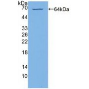 Western blot analysis of recombinant Human PI4Ka.
