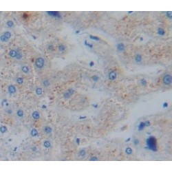 Acetylcholinesterase Associated Protein (ACHAP) Antibody