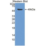 Western blot analysis of the recombinant protein.