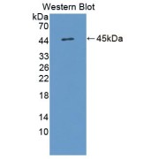 abx129210