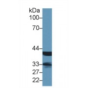 Western blot analysis of Rat Lymph node lysate, using Human LMAN2 Antibody (1 µg/ml) and HRP-conjugated Goat Anti-Rabbit antibody (<a href="https://www.abbexa.com/index.php?route=product/search&amp;search=abx400043" target="_blank">abx400043</a>, 0.2 µg/ml).