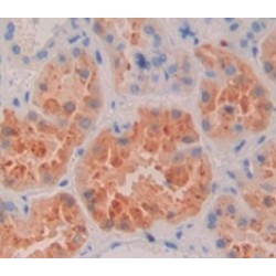 Mannosidase Alpha Class 2B Member 1 (MAN2B1) Antibody