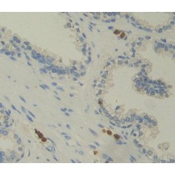 Photoreceptor Cell Specific Nuclear Receptor / PNR (NR2E3) Antibody