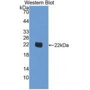 Western blot analysis of recombinant Human SMOX.