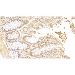 Spermine Oxidase (SMOX) Antibody