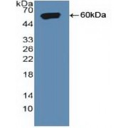 Western blot analysis of recombinant Human SORT1 Protein (with N-terminal His and GST tags).