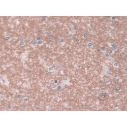 Semenogelin I (SEMG1) Antibody