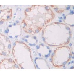 Lysophosphatidylcholine Acyltransferase 1 (LPCAT1) Antibody