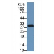 Western blot analysis of Pig Adrenal gland lysate, using Human STAR Antibody (1 µg/ml) and HRP-conjugated Goat Anti-Rabbit antibody (<a href="https://www.abbexa.com/index.php?route=product/search&amp;search=abx400043" target="_blank">abx400043</a>, 0.2 µg/ml).