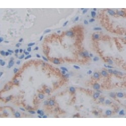 Steroidogenic Acute Regulatory Protein (STAR) Antibody