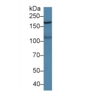 Western blot analysis of Pig Cerebrum lysate, using Human MAST2 Antibody (2 µg/ml) and HRP-conjugated Goat Anti-Rabbit antibody (<a href="https://www.abbexa.com/index.php?route=product/search&amp;search=abx400043" target="_blank">abx400043</a>, 0.2 µg/ml).