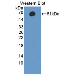 Microtubule Associated Serine/Threonine Kinase 2 (MAST2) Antibody