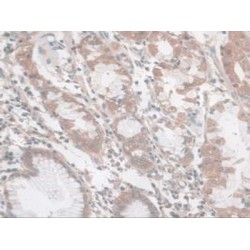 Nesprin 2 (SYNE2) Antibody
