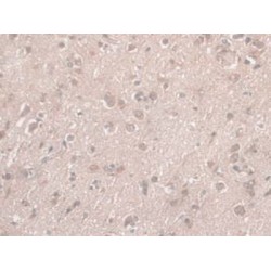 Nesprin 2 (SYNE2) Antibody
