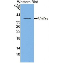 Dedicator of Cytokinesis 4 (DOCK4) Antibody