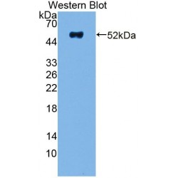 Non Metastatic Cells 5, Protein NM23A Expressed In (NME5) Antibody
