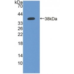 Interferon Induced Protein 35 (IFI35) Antibody