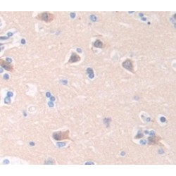 RIO Kinase 1 (RIOK1) Antibody