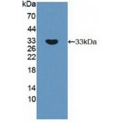 Western blot analysis of recombinant Human RPS6Kb1.