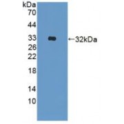 Western blot analysis of recombinant Human ADAM33.