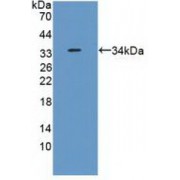 Western blot analysis of recombinant Human RPS6Ka1.