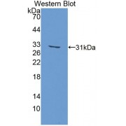 Western blot analysis of recombinant Human CSDE1.