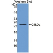 Western blot analysis of recombinant Zinc Finger Homeobox Protein 4.