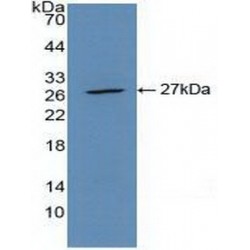 Actin Alpha 2, Smooth Muscle (ACTA2) Antibody