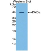 Western blot analysis of recombinant Mouse GHRL.