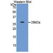 Western blot analysis of recombinant Mouse ICAM4.