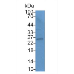 Intercellular Adhesion Molecule 4 (ICAM4) Antibody