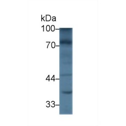 Nexilin (NEXN) Antibody