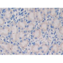 Nexilin (NEXN) Antibody