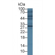 Western blot analysis of Mouse Small intestine lysate, using Mouse IL4R Antibody (1 µg/ml) and HRP-conjugated Goat Anti-Rabbit antibody (<a href="https://www.abbexa.com/index.php?route=product/search&amp;search=abx400043" target="_blank">abx400043</a>, 0.2 µg/ml).