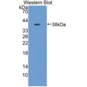 Western blot analysis of recombinant Mouse MT1 Protein.