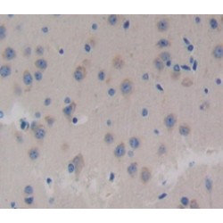 Neurocan (NCAN) Antibody