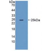 Western blot analysis of recombinant Mouse XCR1.