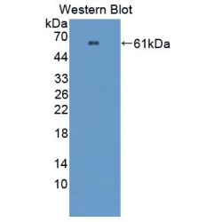 Prolylcarboxypeptidase (PRCP) Antibody
